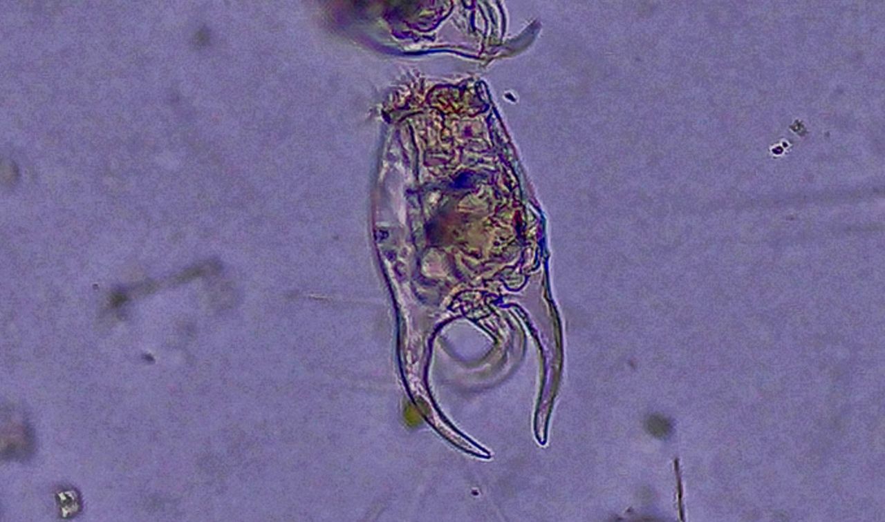 L�ingegnere idrodinamico dello stagno: alla scoperta del rotifero Brachionus